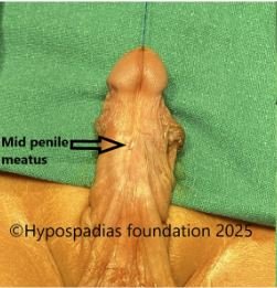 40img1 40img1