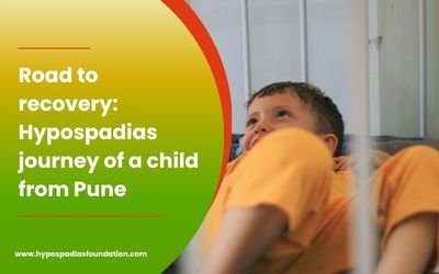 Road to recovery: Hypospadias journey of a child from Pune