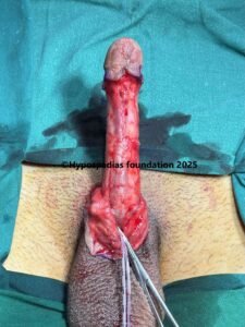 case42img5