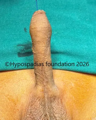 blogimg5